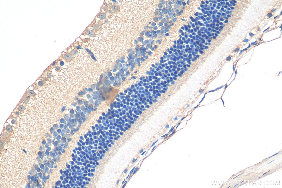 IHC staining of mouse eye using 26205-1-AP