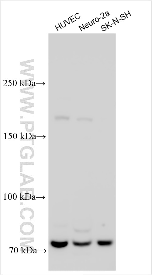 Western Blot (WB) analysis of various lysates using Piezo2 Polyclonal antibody (26205-1-AP)