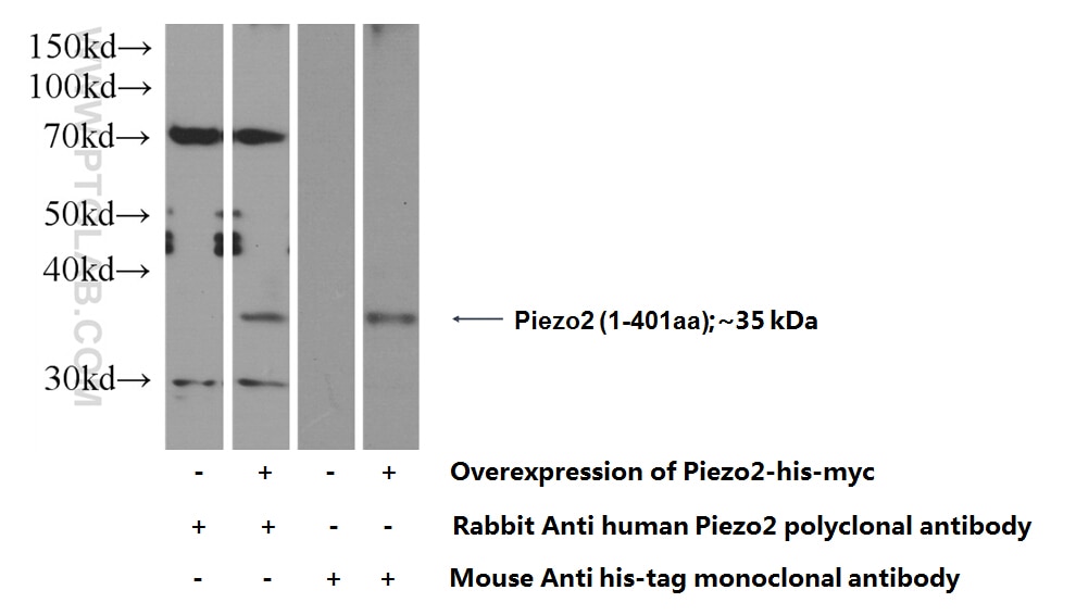 Piezo2 Polyclonal antibody