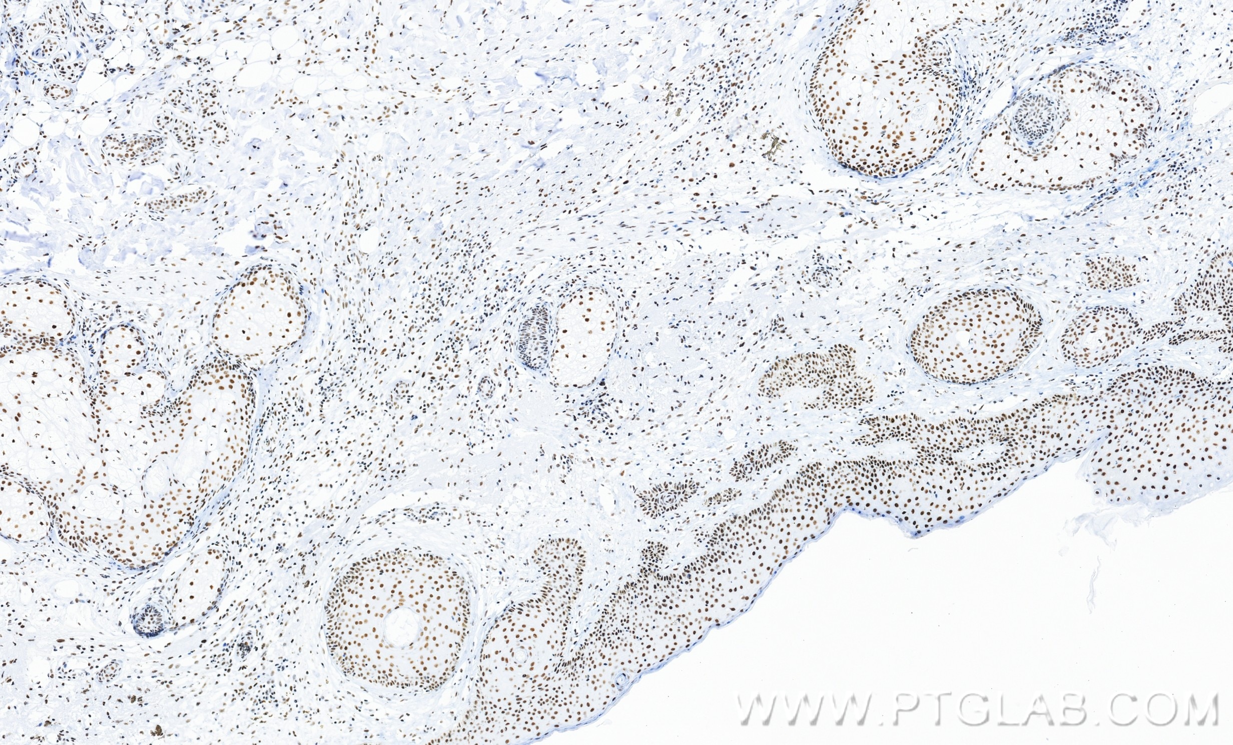 Immunohistochemistry (IHC) staining of human skin tissue using Pinin Recombinant monoclonal antibody (86292-1-RR)