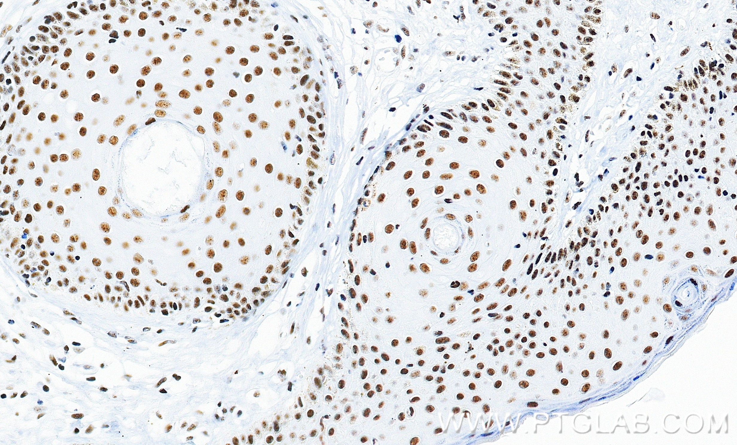 Immunohistochemistry (IHC) staining of human skin tissue using Pinin Recombinant monoclonal antibody (86292-1-RR)