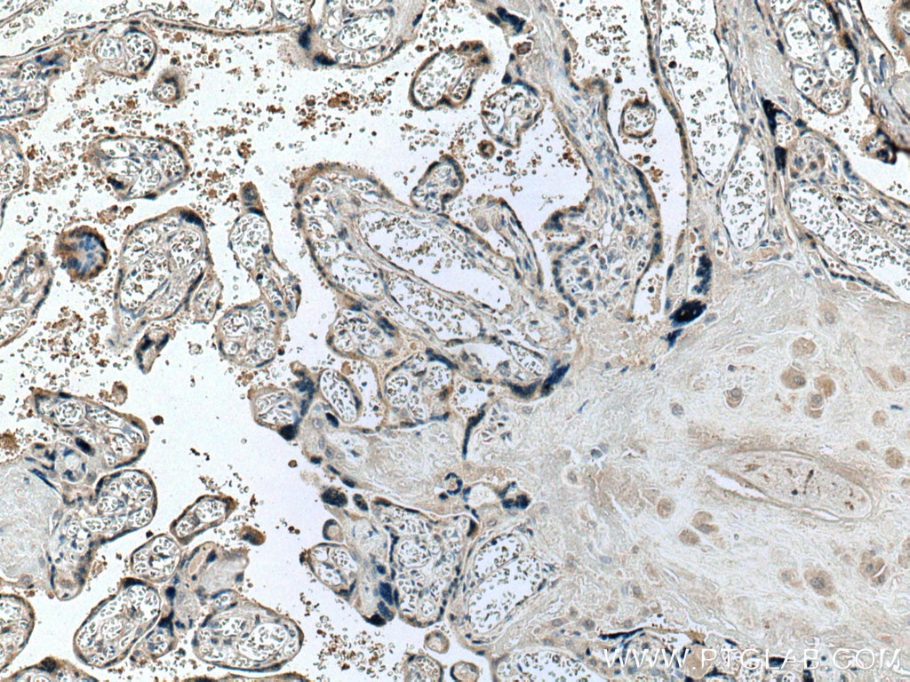 Immunohistochemistry (IHC) staining of human placenta tissue using Placental lactogen Monoclonal antibody (66728-1-Ig)