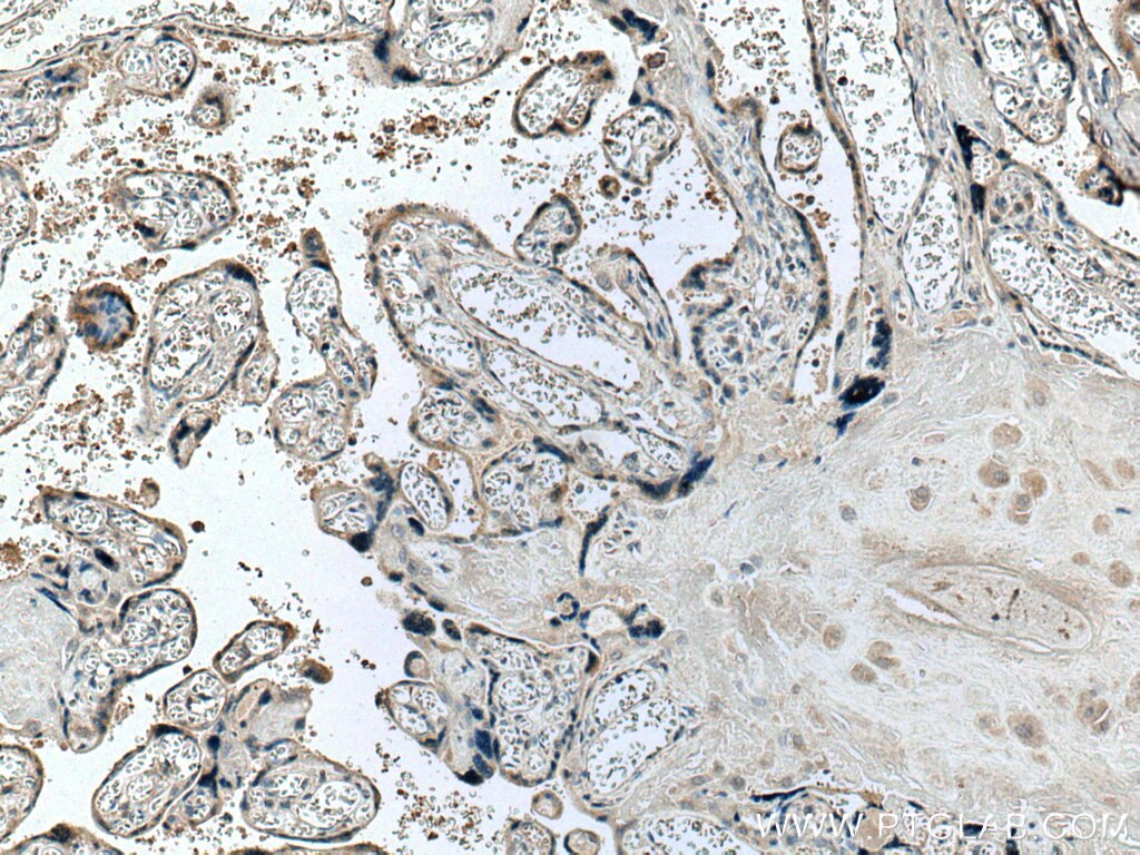 IHC staining of human placenta using 66728-1-Ig