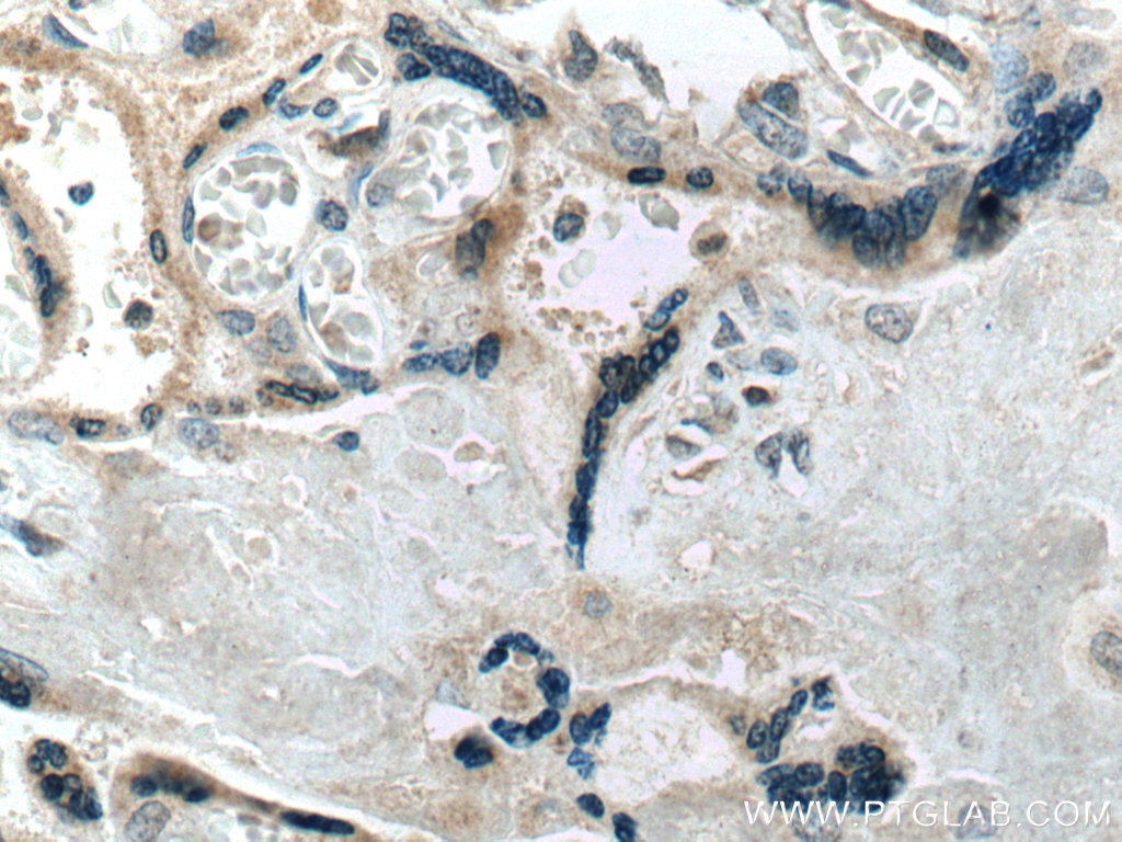 IHC staining of human placenta using 66728-1-Ig