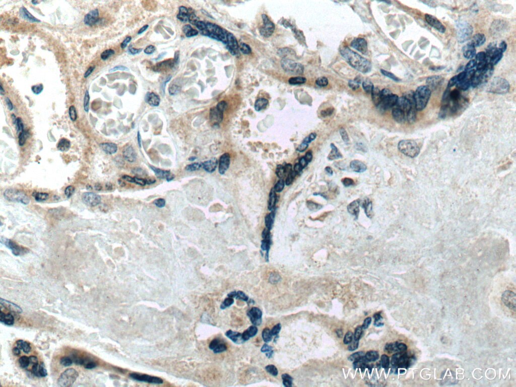 Immunohistochemistry (IHC) staining of human placenta tissue using Placental lactogen Monoclonal antibody (66728-1-Ig)