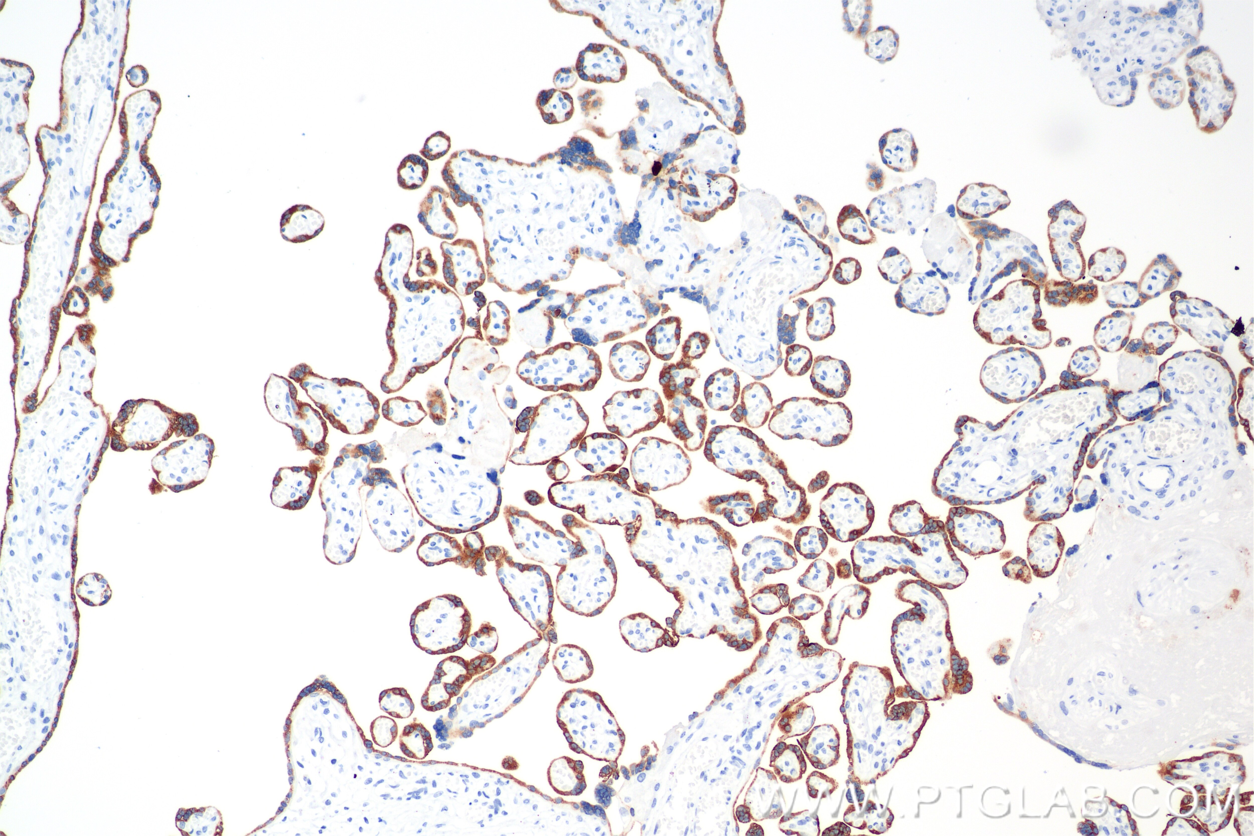 Immunohistochemical analysis of paraffin-embedded human placenta tissue slide using 86658-1-RR (Placental lactogen antibody) at dilution of 1:10000 (under 10x lens). Heat mediated antigen retrieval with Tris-EDTA buffer (pH 9.0). Immunohistochemistry (IHC) staining of human placenta tissue using Placental lactogen Recombinant monoclonal antibody (86658-1-RR)