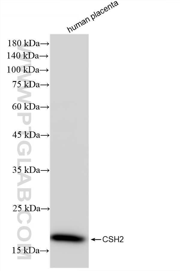 human placenta tissue were subjected to SDS PAGE followed by western blot with 86658-1-RR (CSH2 antibody) at dilution of 1:10000 incubated at room temperature for 1.5 hours. Western Blot (WB) analysis of human placenta tissue using Placental lactogen Recombinant monoclonal antibody (86658-1-RR)