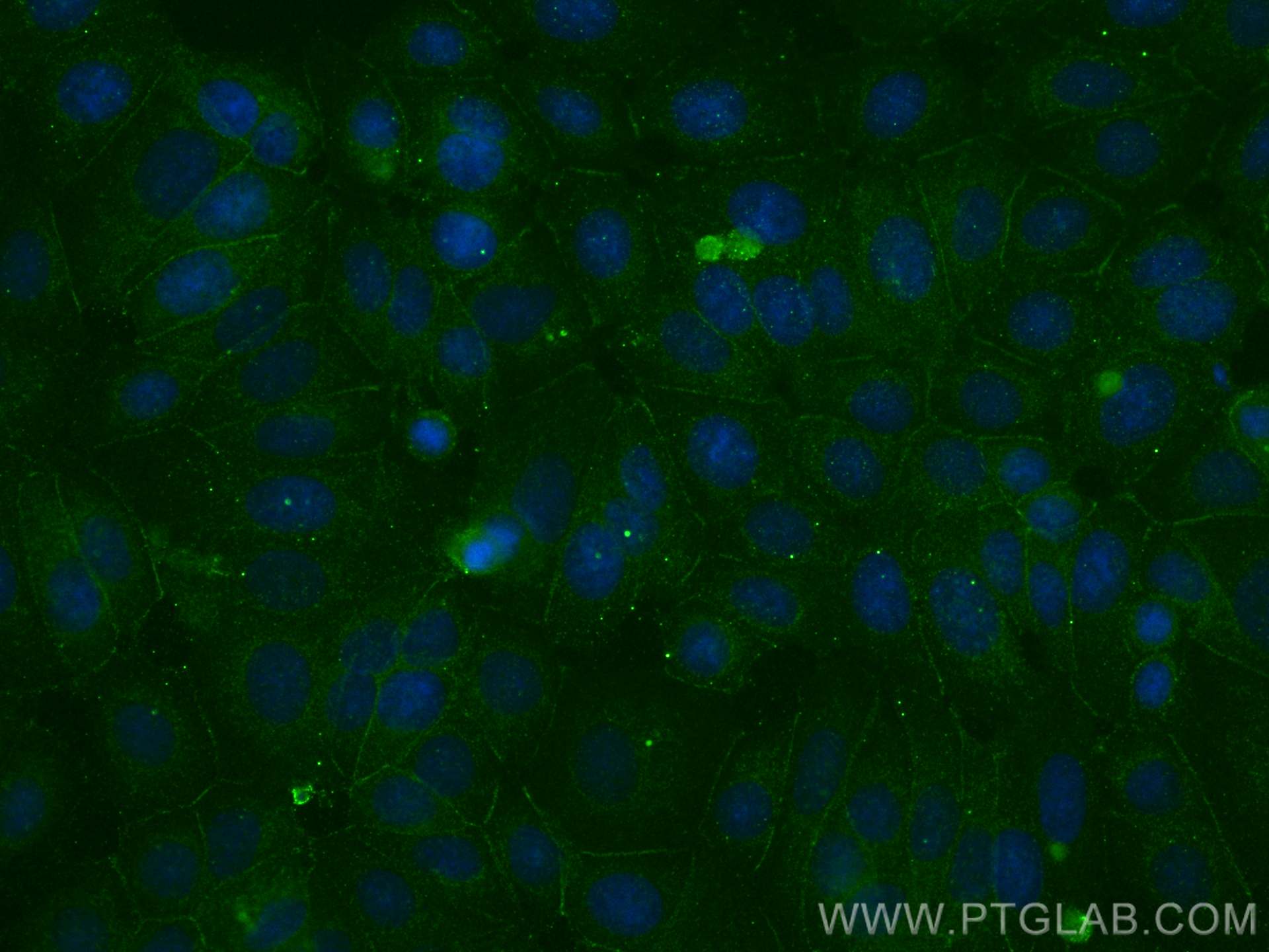 Immunofluorescence (IF) / fluorescent staining of MCF-7 cells using Gamma Catenin Monoclonal antibody (66445-1-Ig)