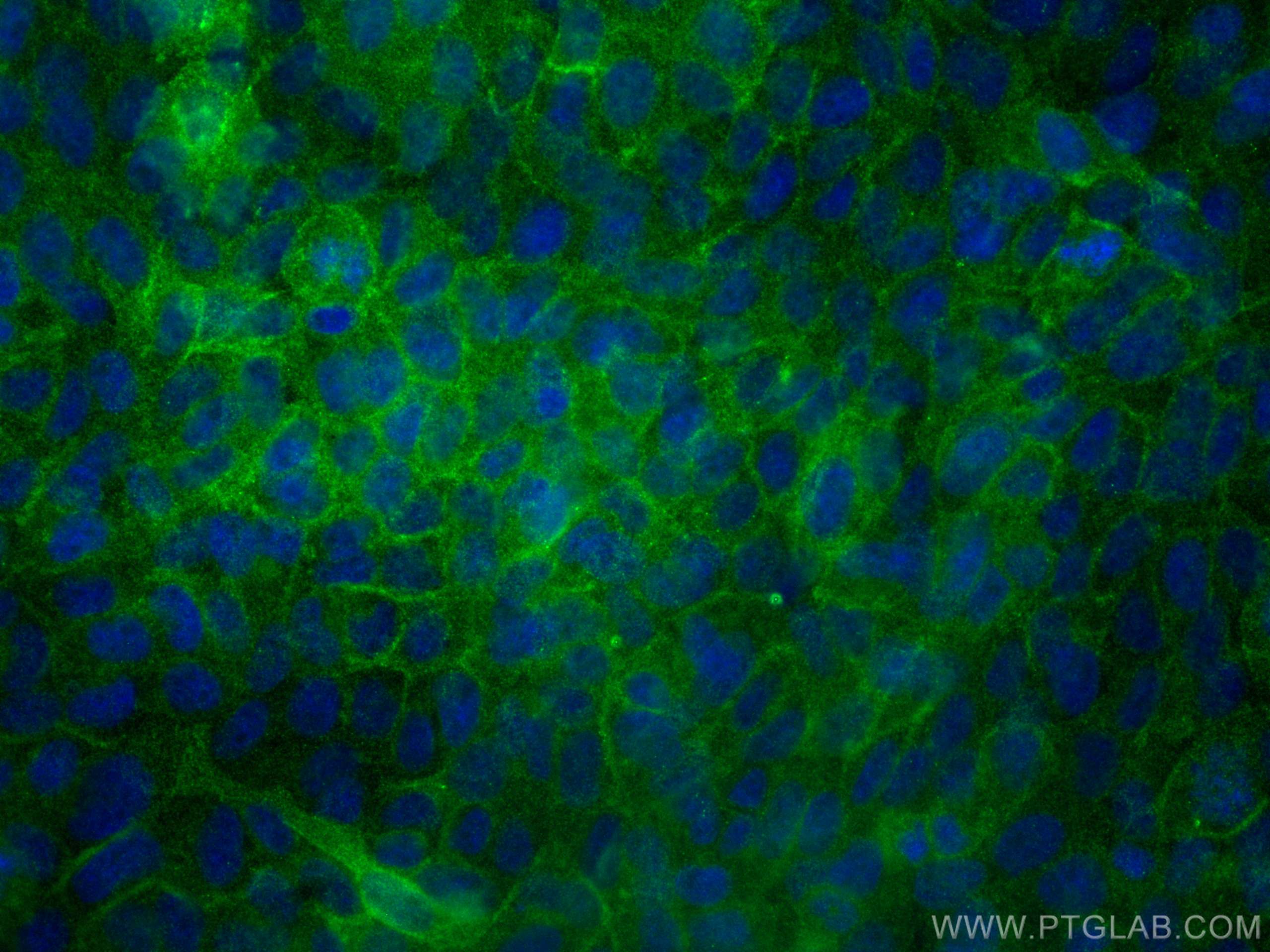 Immunofluorescence (IF) / fluorescent staining of A431 cells using Gamma Catenin Monoclonal antibody (66445-1-Ig)