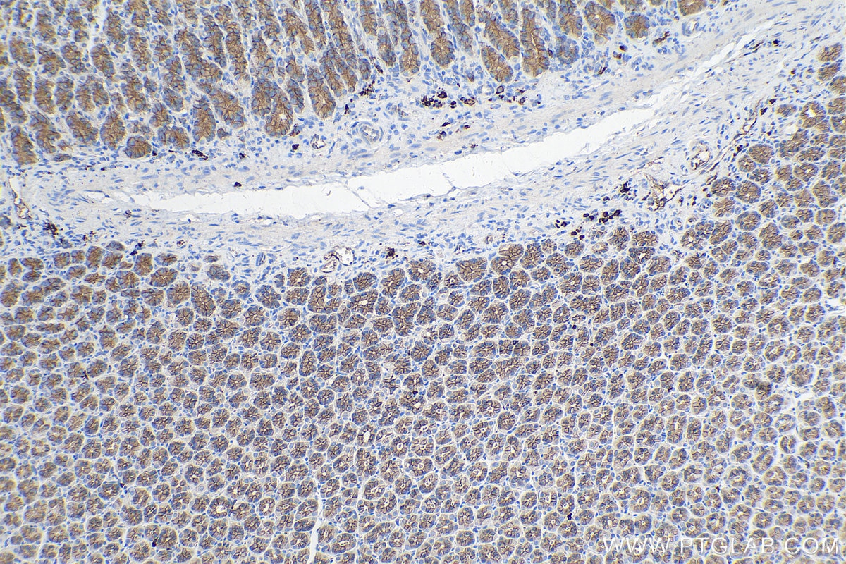 Immunohistochemistry (IHC) staining of rat stomach tissue using Gamma Catenin Monoclonal antibody (66445-1-Ig)