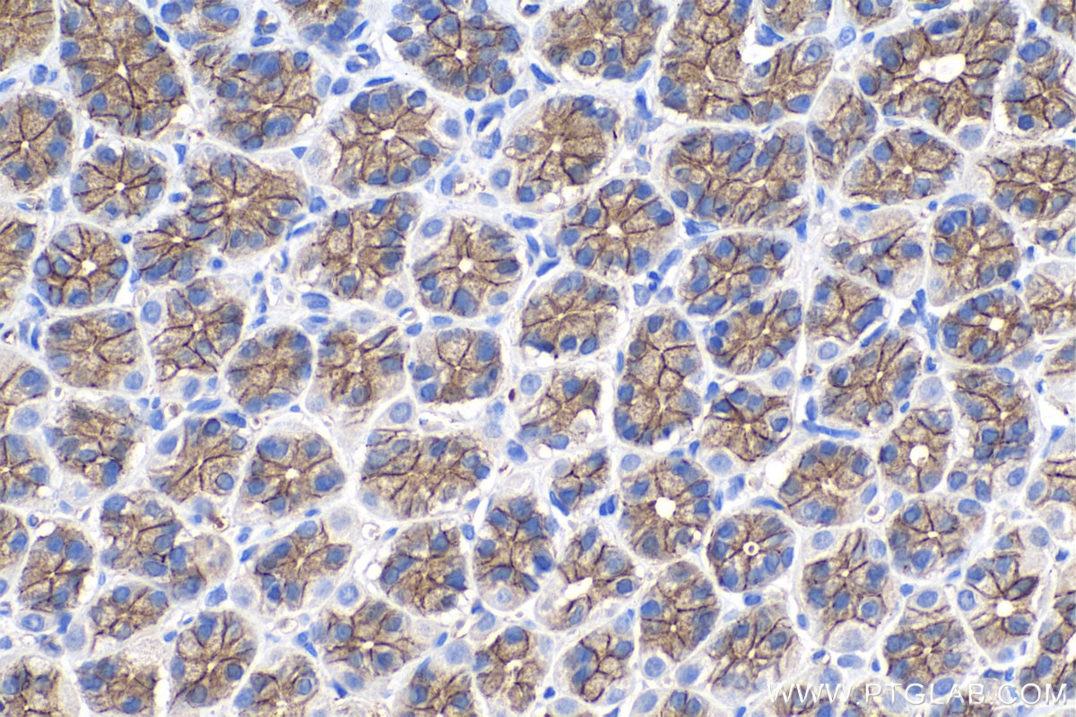 Immunohistochemistry (IHC) staining of rat stomach tissue using Gamma Catenin Monoclonal antibody (66445-1-Ig)