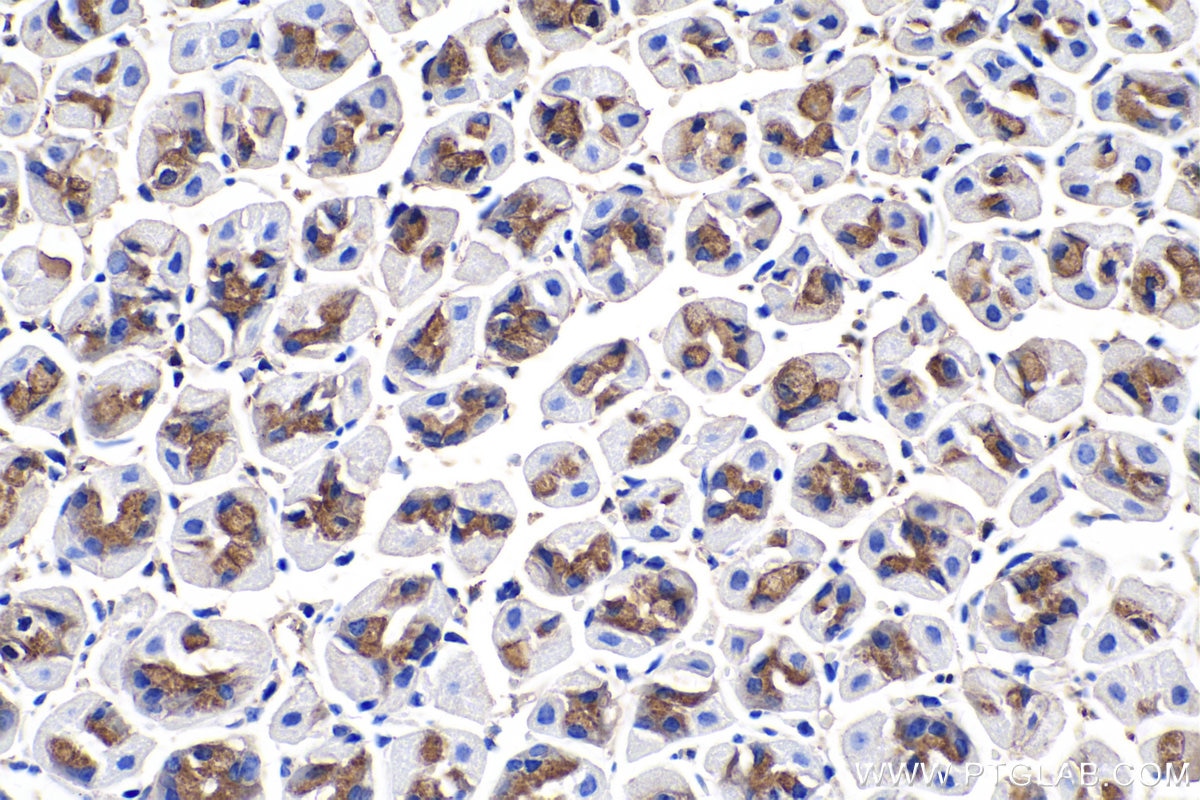 Immunohistochemistry (IHC) staining of mouse stomach tissue using Gamma Catenin Monoclonal antibody (66445-1-Ig)