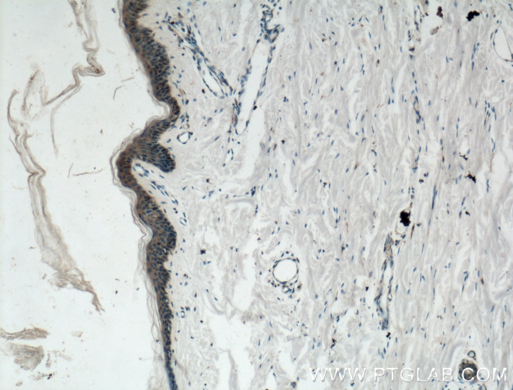 Immunohistochemistry (IHC) staining of human skin tissue using Gamma Catenin Monoclonal antibody (66445-1-Ig)