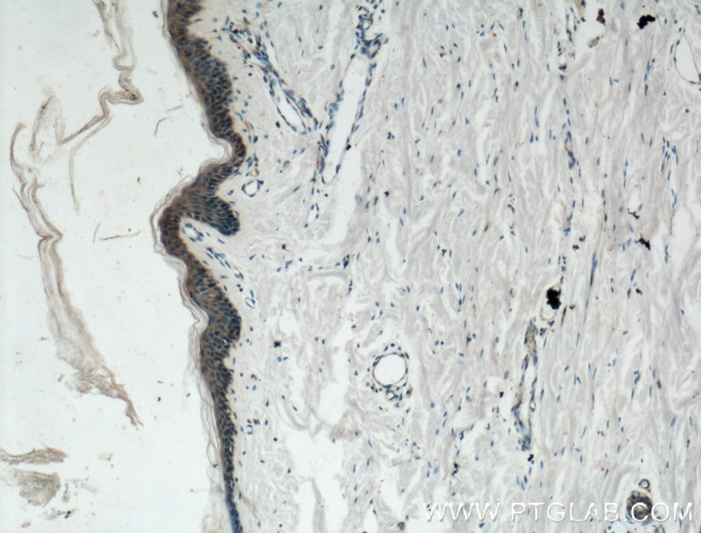 Immunohistochemistry (IHC) staining of human skin tissue using Gamma Catenin Monoclonal antibody (66445-1-Ig)