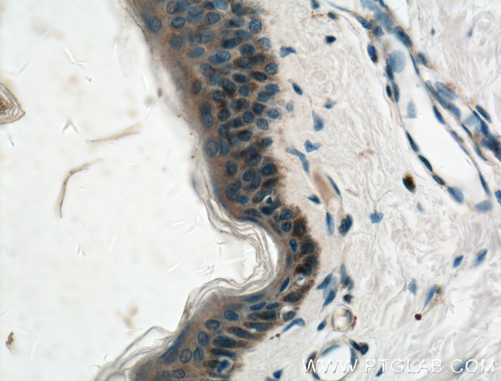 Immunohistochemistry (IHC) staining of human skin tissue using Gamma Catenin Monoclonal antibody (66445-1-Ig)