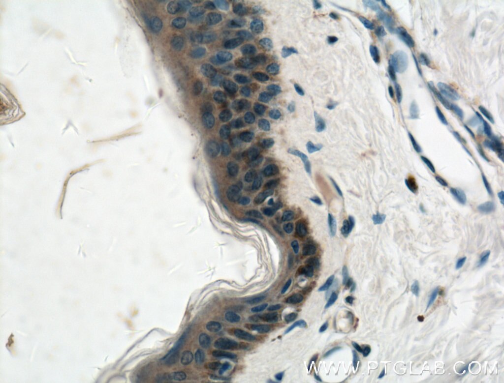 IHC staining of human skin using 66445-1-Ig