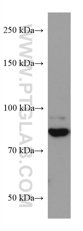 Western Blot (WB) analysis of T-47D cells using Gamma Catenin Monoclonal antibody (66445-1-Ig)
