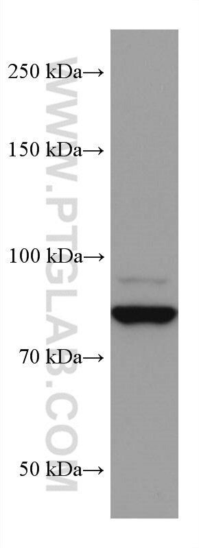 Western Blot (WB) analysis of A431 cells using Gamma Catenin Monoclonal antibody (66445-1-Ig)