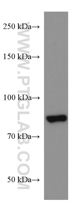 Western Blot (WB) analysis of human heart tissue using Gamma Catenin Monoclonal antibody (66445-1-Ig)