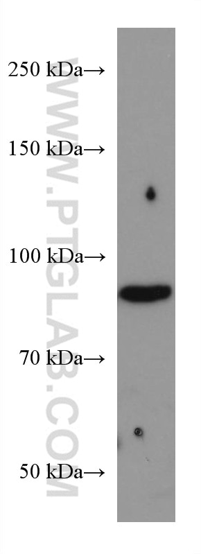 Western Blot (WB) analysis of rat heart tissue using Gamma Catenin Monoclonal antibody (66445-1-Ig)