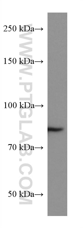 Western Blot (WB) analysis of MDCK cells using Gamma Catenin Monoclonal antibody (66445-1-Ig)