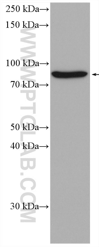 Western Blot (WB) analysis of HT-29 cells using Gamma Catenin Monoclonal antibody (66445-1-Ig)