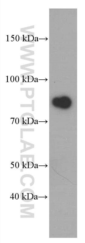 Western Blot (WB) analysis of human heart tissue using Gamma Catenin Monoclonal antibody (66445-1-Ig)