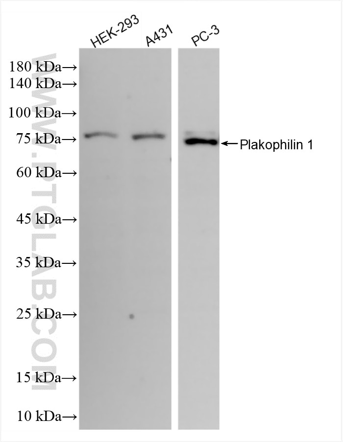 Plakophilin 1