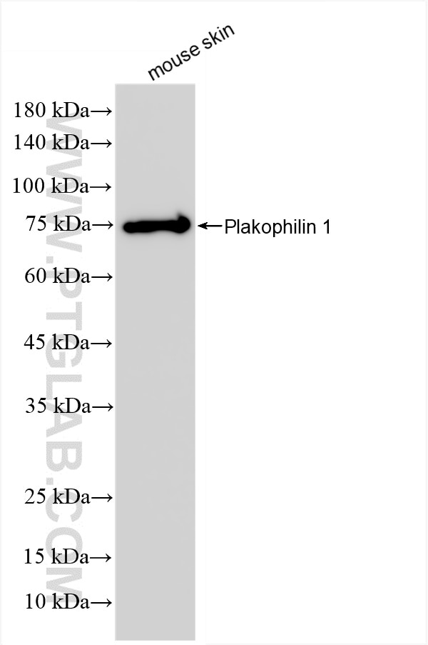 Western Blot (WB) analysis of mouse skin tissue using Plakophilin 1 Recombinant antibody (85217-4-RR)