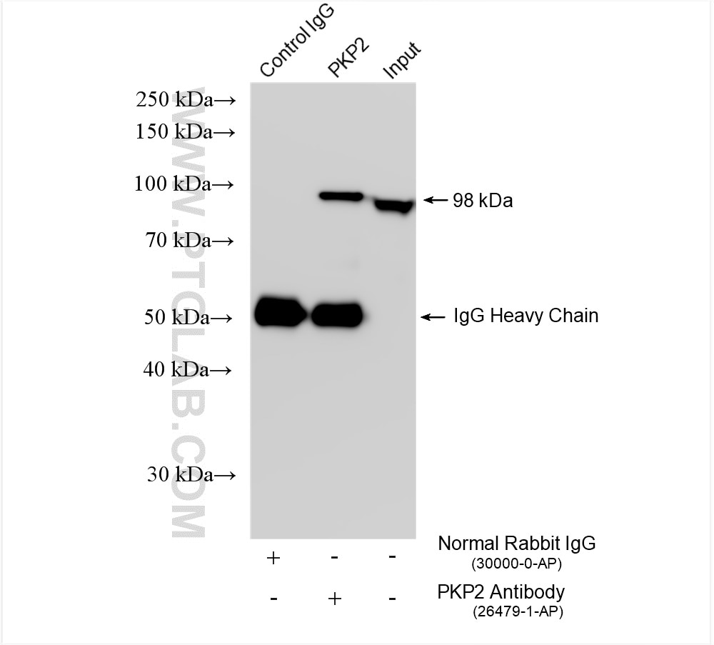 Immunoprecipitation (IP) experiment of HepG2 cells using human Plakophilin 2 Polyclonal antibody (26479-1-AP)