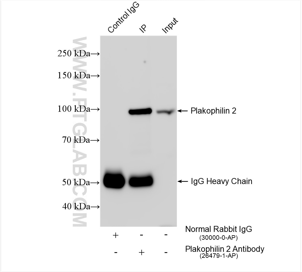 Immunoprecipitation (IP) experiment of HepG2 cells using Plakophilin 2 Polyclonal antibody (26479-1-AP)
