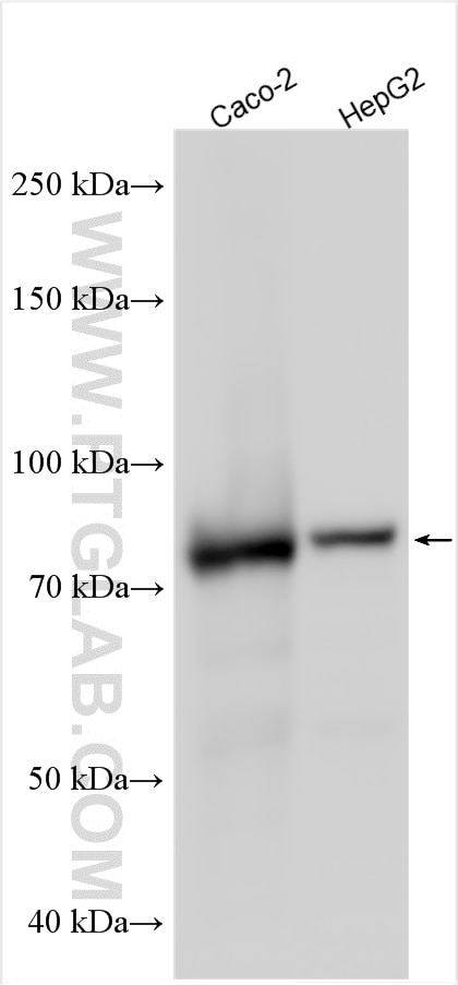 Western Blot (WB) analysis of various lysates using Plakophilin 2 Polyclonal antibody (26479-1-AP)