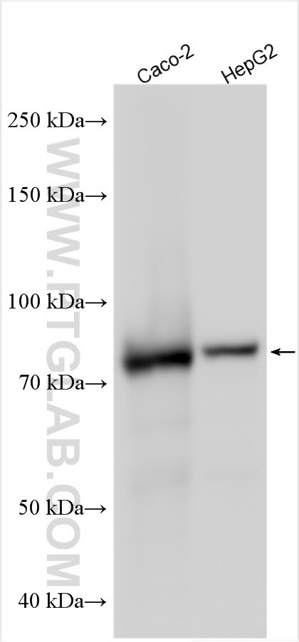 Plakophilin 2