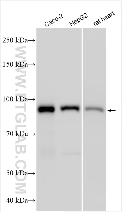 Western Blot (WB) analysis of various lysates using Plakophilin 2 Polyclonal antibody (26479-1-AP)