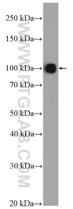 Western Blot (WB) analysis of human plasma using Plasminogen Polyclonal antibody (26768-1-AP)