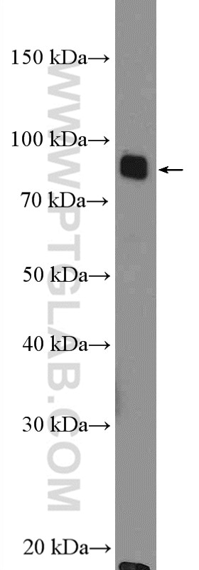 Western Blot (WB) analysis of Raji cells using Plasminogen Polyclonal antibody (26768-1-AP)