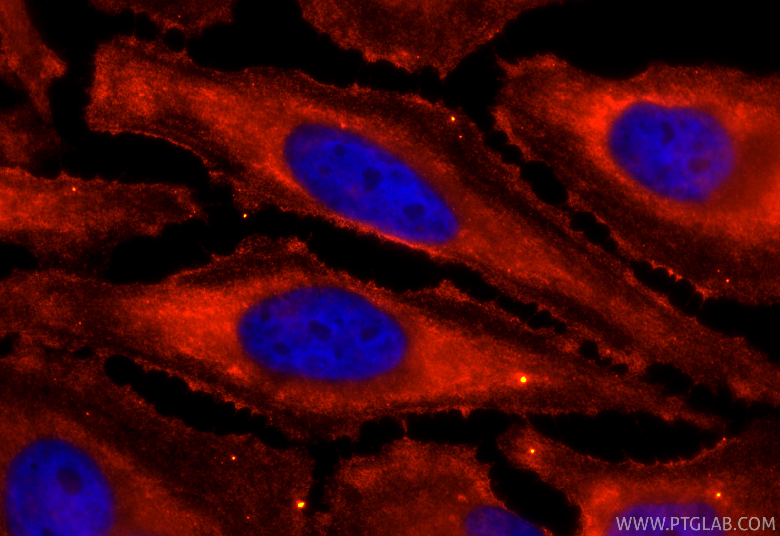Immunofluorescence (IF) / fluorescent staining of HeLa cells using CoraLite®594-conjugated Plasminogen Monoclonal ant (CL594-66399)