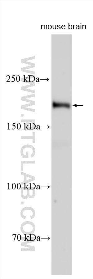 Western Blot (WB) analysis of various lysates using Plexin C1 Polyclonal antibody (33781-1-AP)
