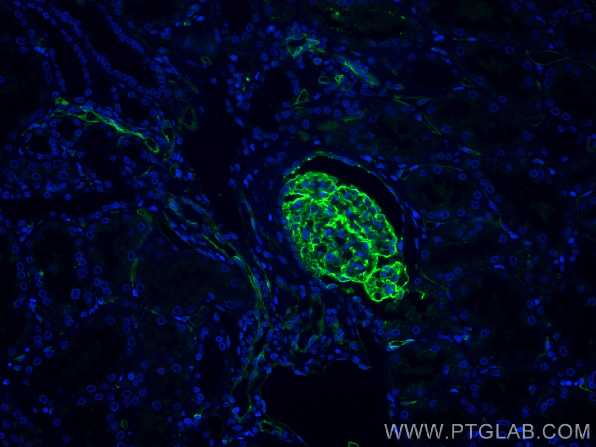 Immunofluorescence (IF) / fluorescent staining of human kidney tissue using Podocalyxin Monoclonal antibody (68250-1-Ig)