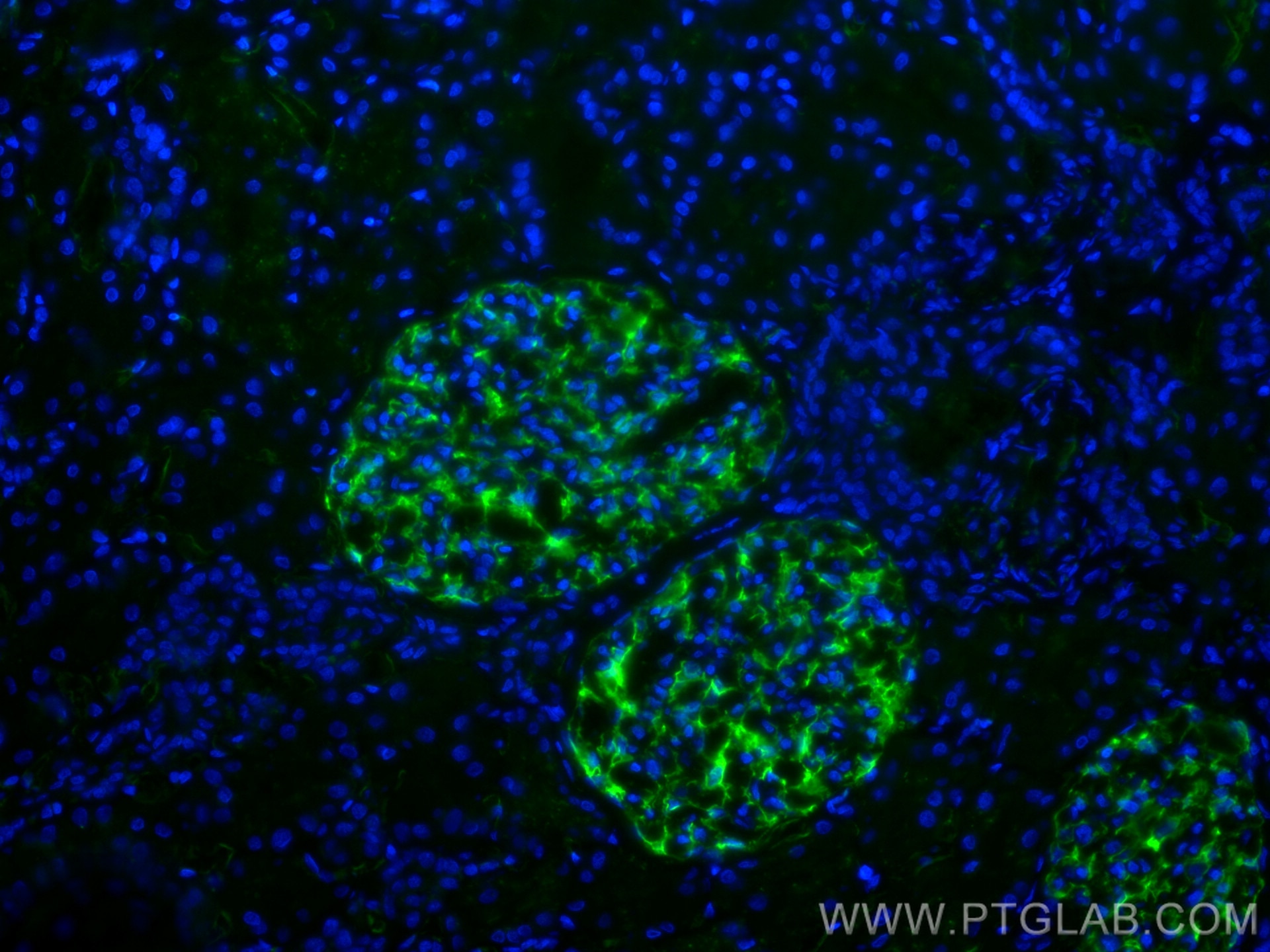 Immunofluorescence (IF) / fluorescent staining of human kidney tissue using Podocalyxin Monoclonal antibody (68250-1-Ig)