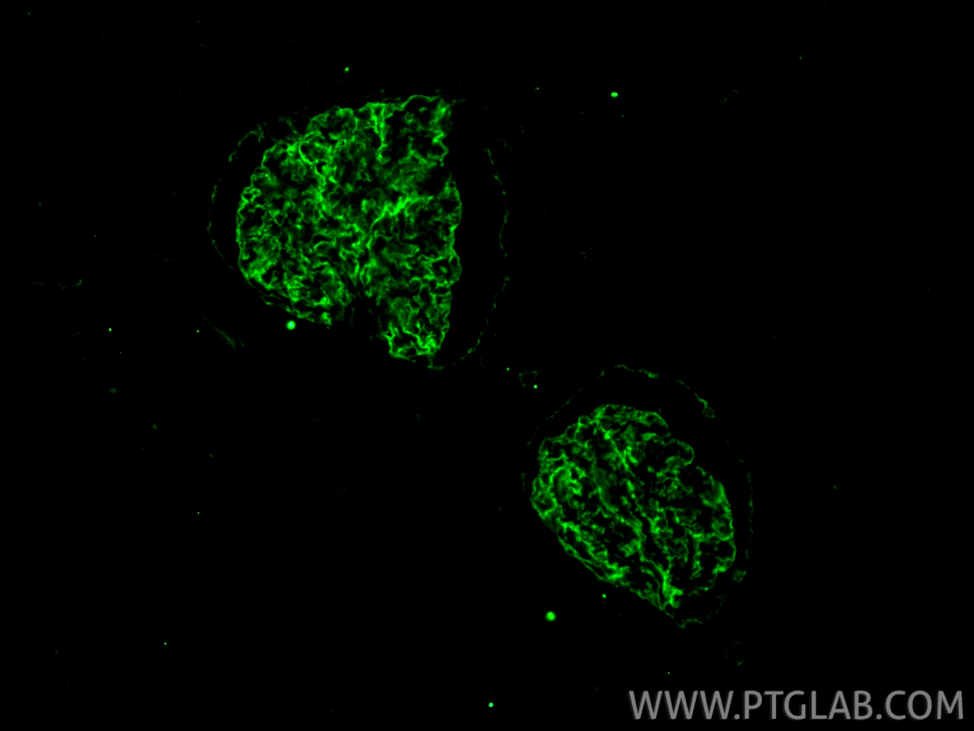 Immunofluorescence (IF) / fluorescent staining of human kidney tissue using Podocalyxin Monoclonal antibody (68250-1-Ig)