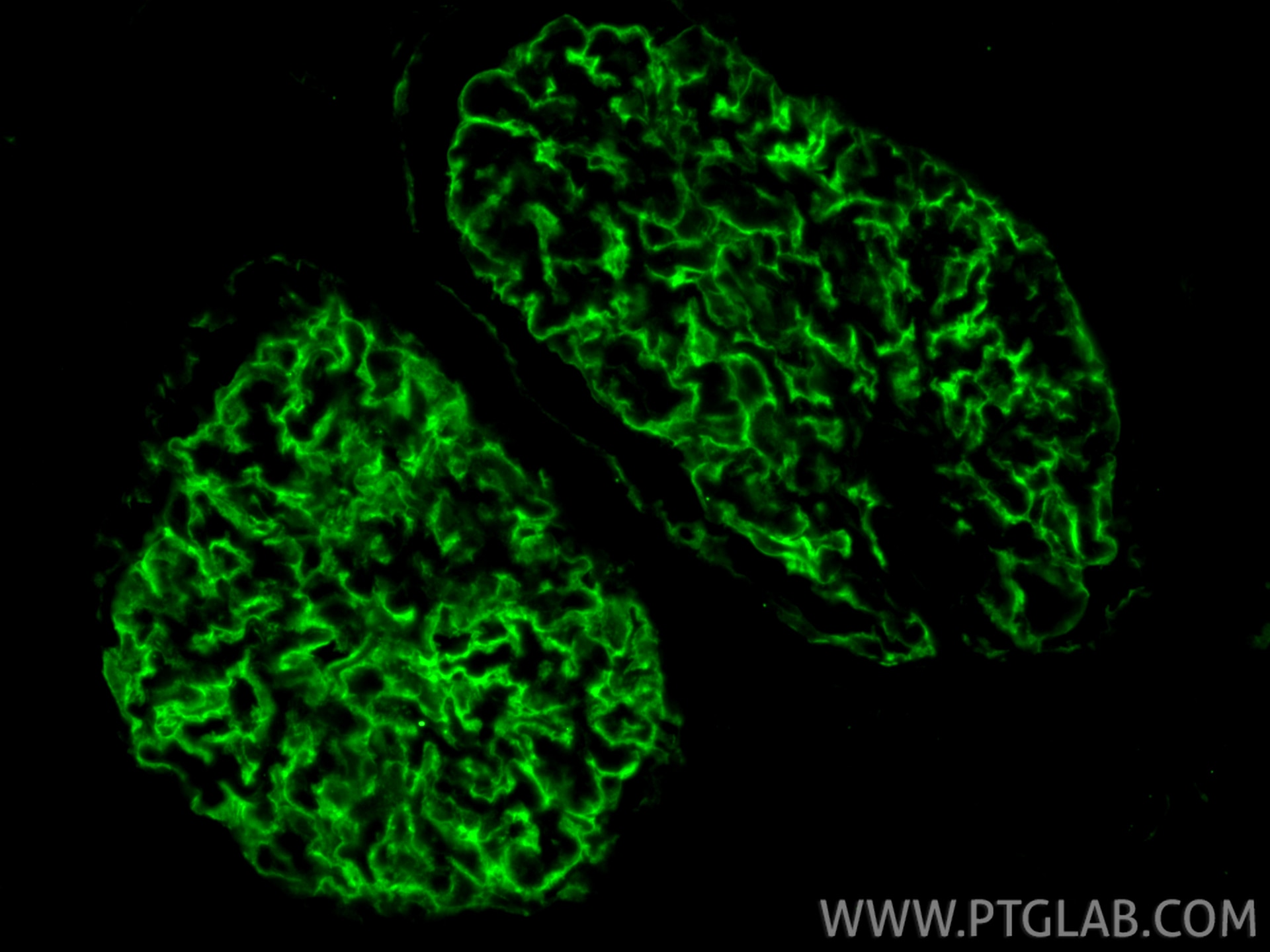 Immunofluorescence (IF) / fluorescent staining of human kidney tissue using Podocalyxin Monoclonal antibody (68250-1-Ig)