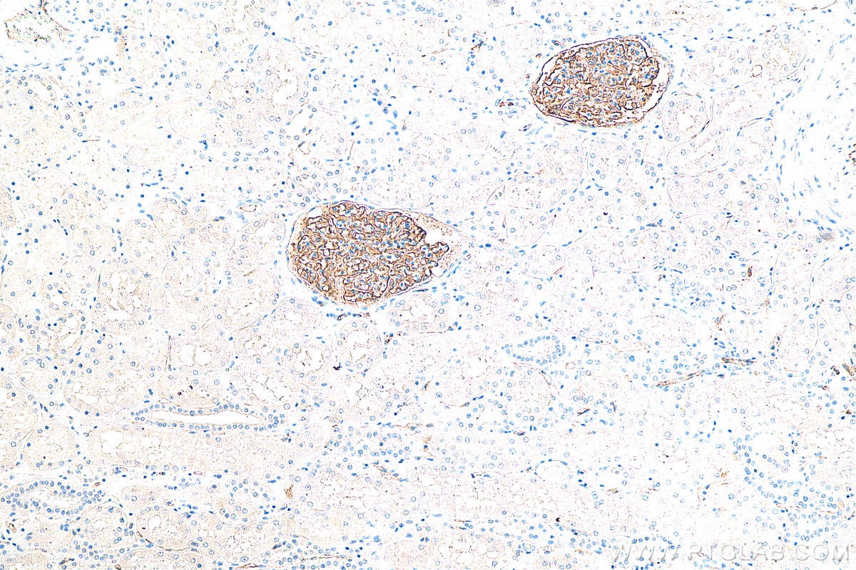 Immunohistochemistry (IHC) staining of human kidney tissue using Podocalyxin Monoclonal antibody (68250-1-Ig)