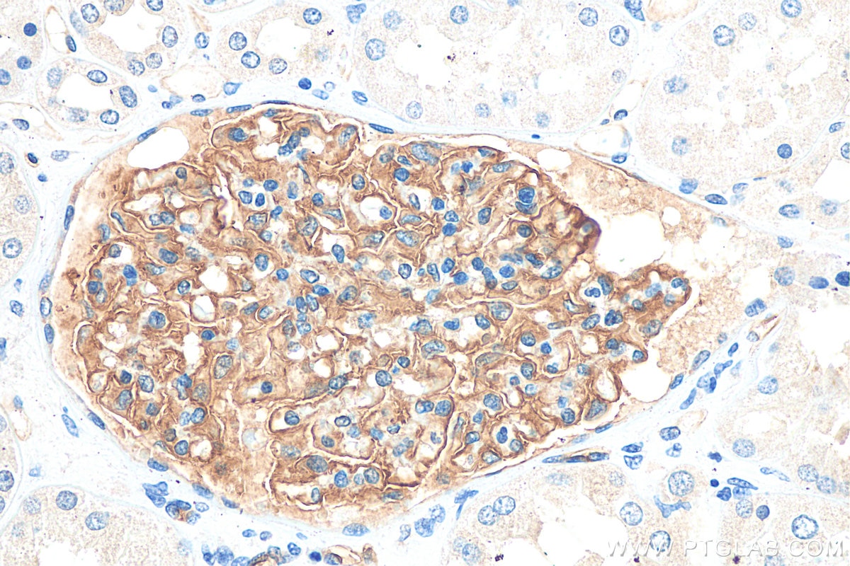 Immunohistochemistry (IHC) staining of human kidney tissue using Podocalyxin Monoclonal antibody (68250-1-Ig)