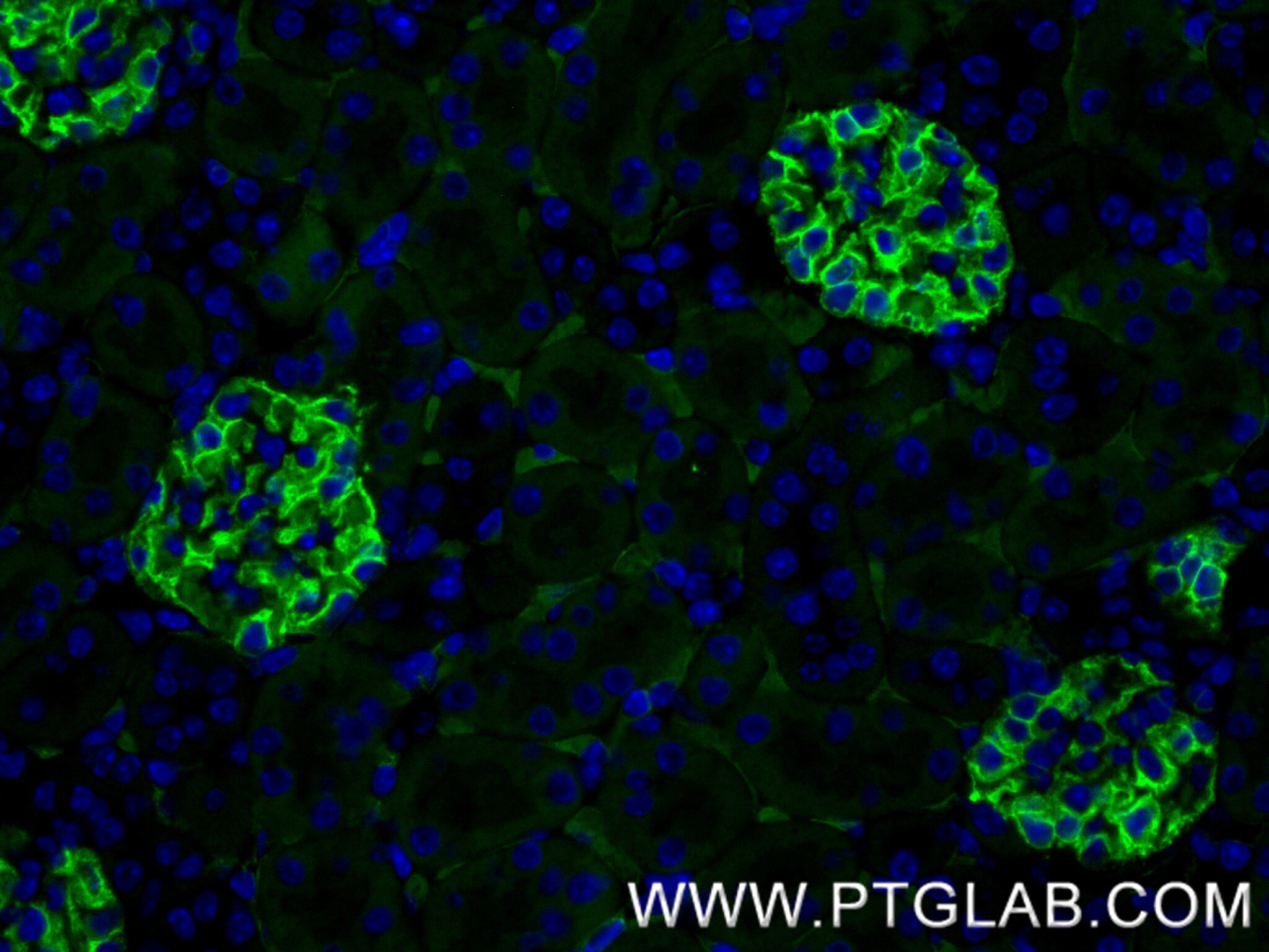 Immunofluorescence (IF) / fluorescent staining of mouse kidney tissue using Podocalyxin Recombinant monoclonal antibody (87582-2-RR)