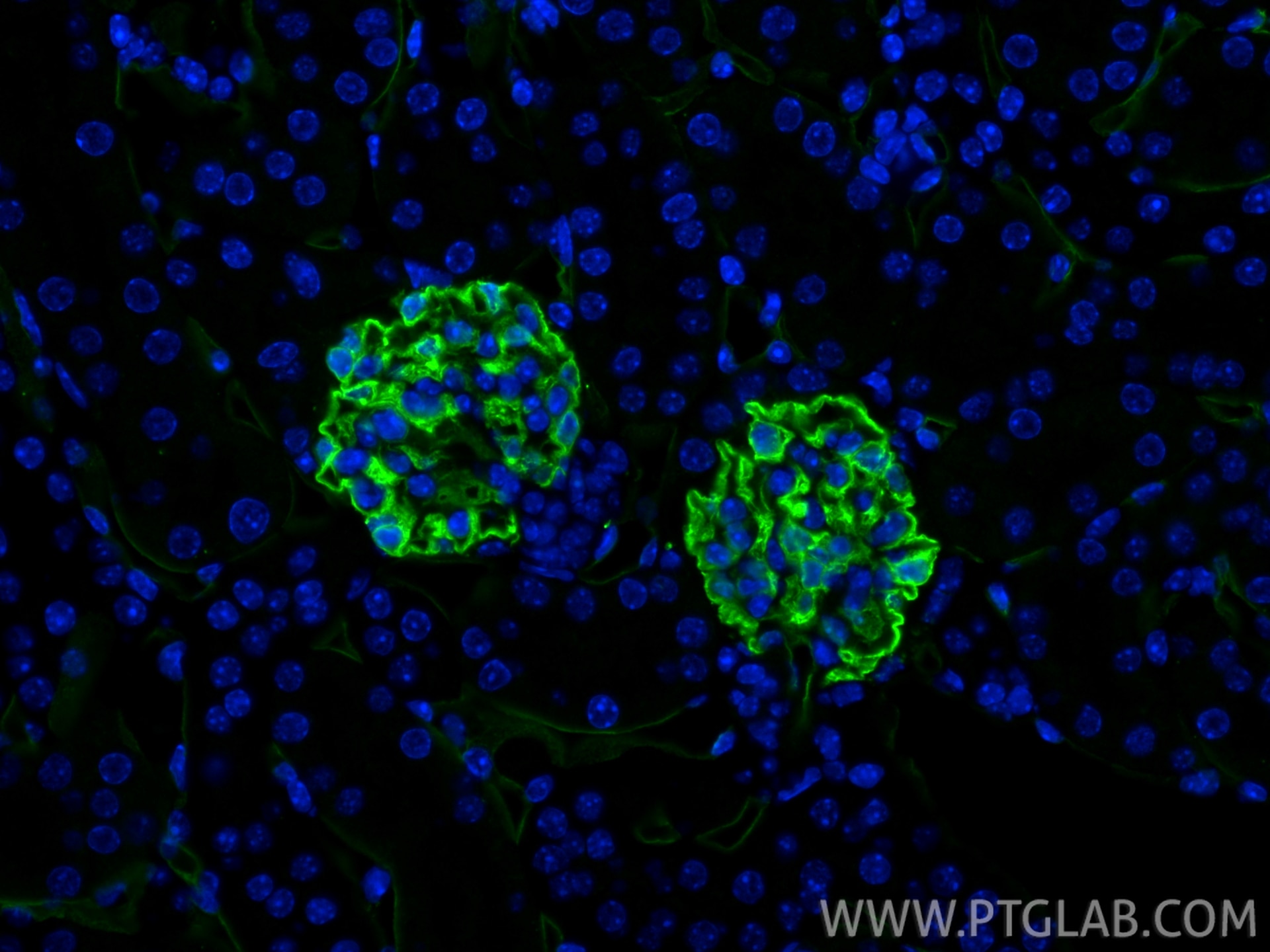 Immunofluorescence (IF) / fluorescent staining of mouse kidney tissue using Podocalyxin Recombinant monoclonal antibody (87582-2-RR)