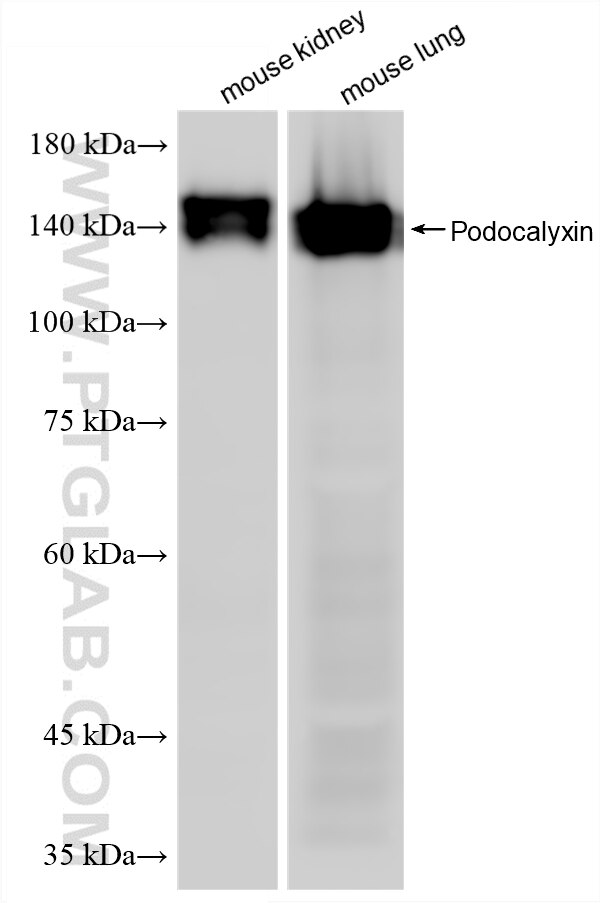 Western Blot (WB) analysis of various lysates using Podocalyxin Recombinant monoclonal antibody (87582-2-RR)