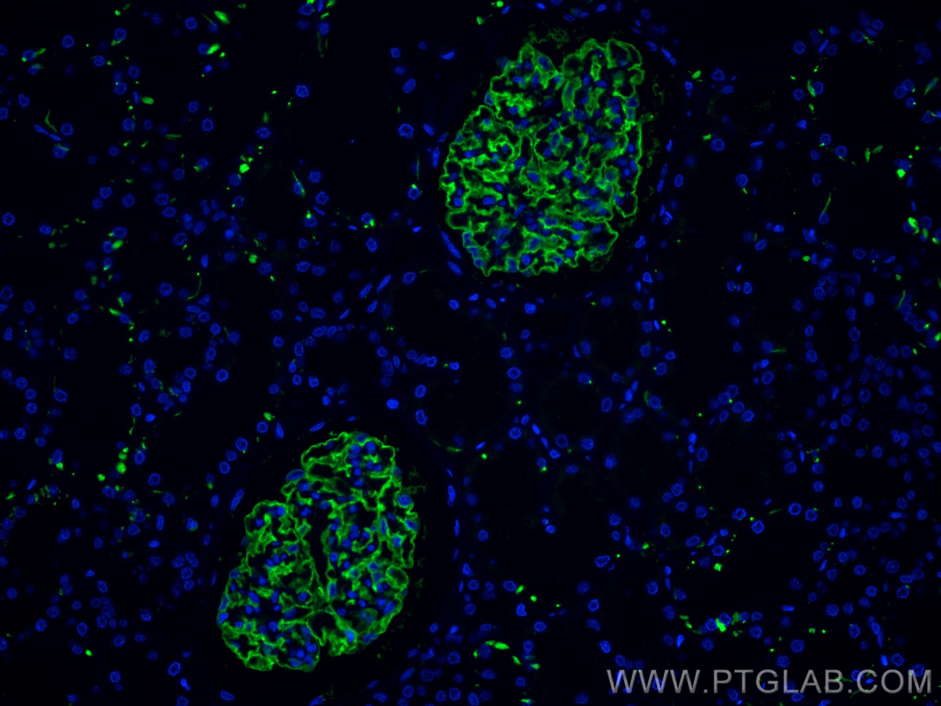 Immunofluorescence (IF) / fluorescent staining of human kidney tissue using CoraLite® Plus 488-conjugated Podocalyxin Polyclon (CL488-18150)