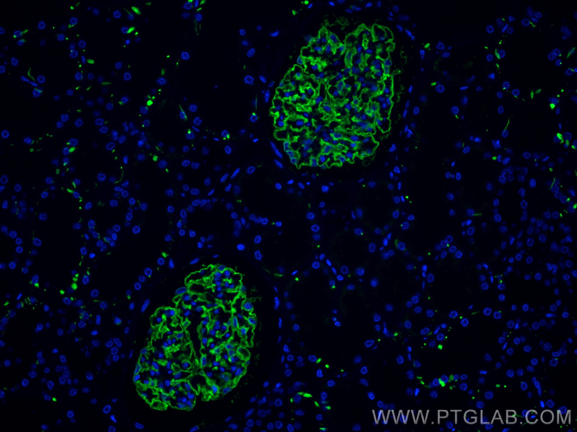 Podocalyxin