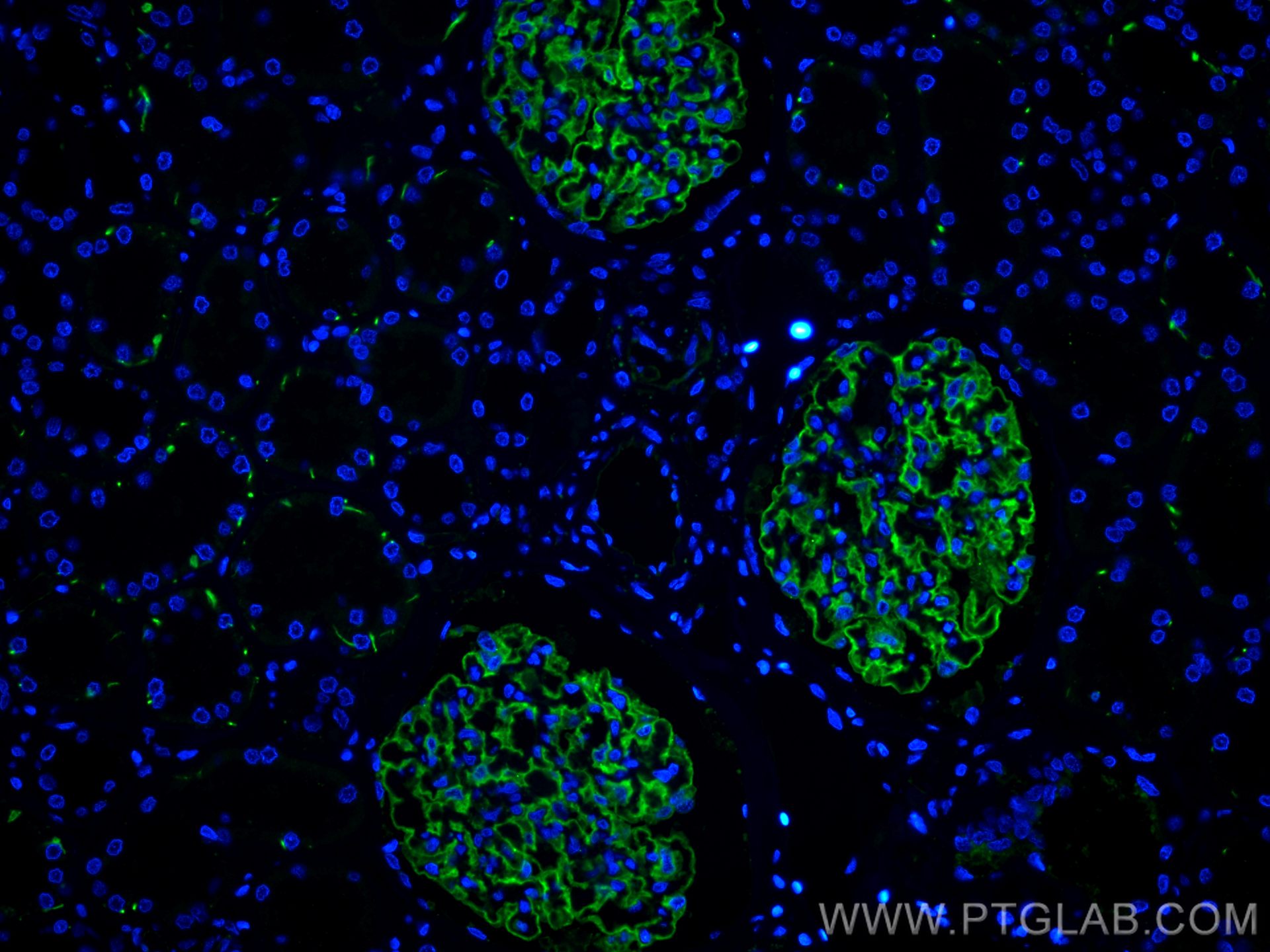 Immunofluorescence (IF) / fluorescent staining of human kidney tissue using CoraLite® Plus 488-conjugated Podocalyxin Polyclon (CL488-18150)